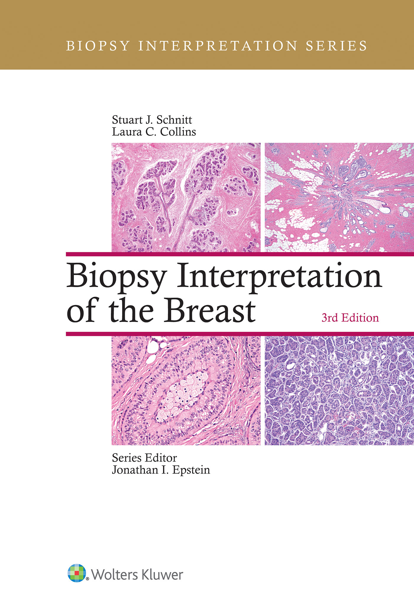 Biopsy Interpretation Of The Breast